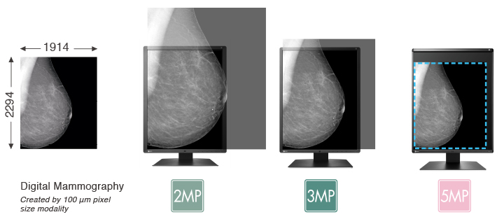 ViewMammographyImageClearly
